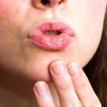 Сухость во рту — это симптом обезвоживания