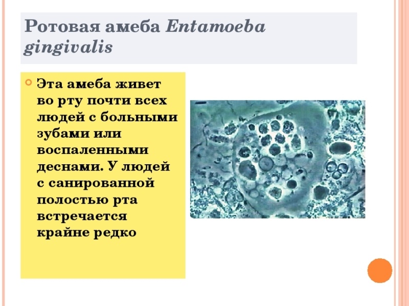 Стадия амебы поражающая толстый кишечник человека. Ротовая амеба Entamoeba gingivalis. Entamoeba gingivalis строение. Жизненные формы Entamoeba gingivalis. Entamoeba gingivalis жизненный цикл.
