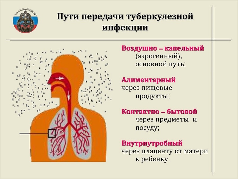 пути заражения при туберкулезе