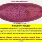 Фасциолопсидоз — опять паразиты