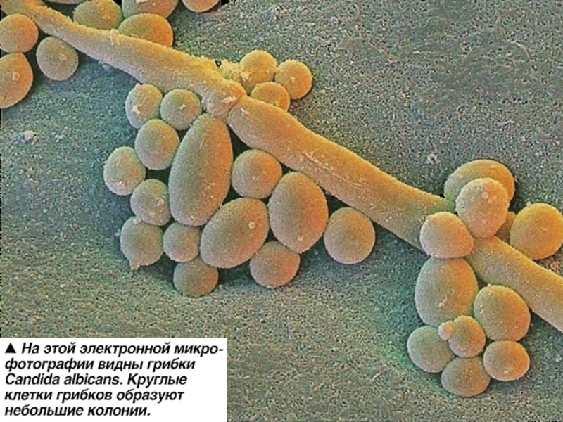 Молочница бактерии. Дрожжеподобный гриб Candida albicans. Candida albicans под микроскопом. Грибок кандида под микро.